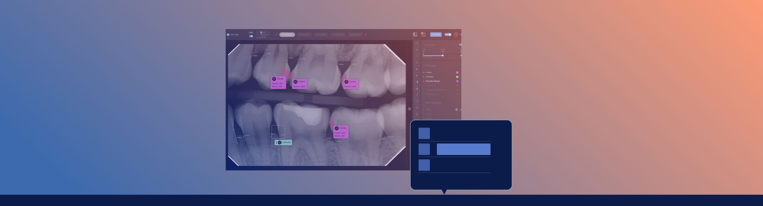 Instructions for Bridge Install and open tray app